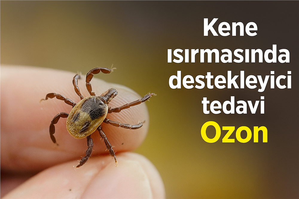 Kene ısırmasında destekleyici tedavi: Ozon Kene ısırmasında destekleyici tedavi: Ozon